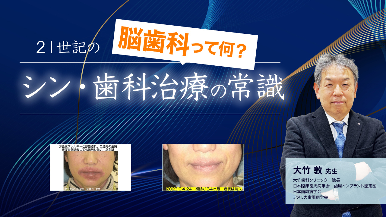 脳歯科って何?21世記のシン・歯科治療の常識の画像です。