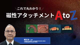 確実に患者満足度が上がる！“リンゴ丸かじりができる”全部床義歯～今井