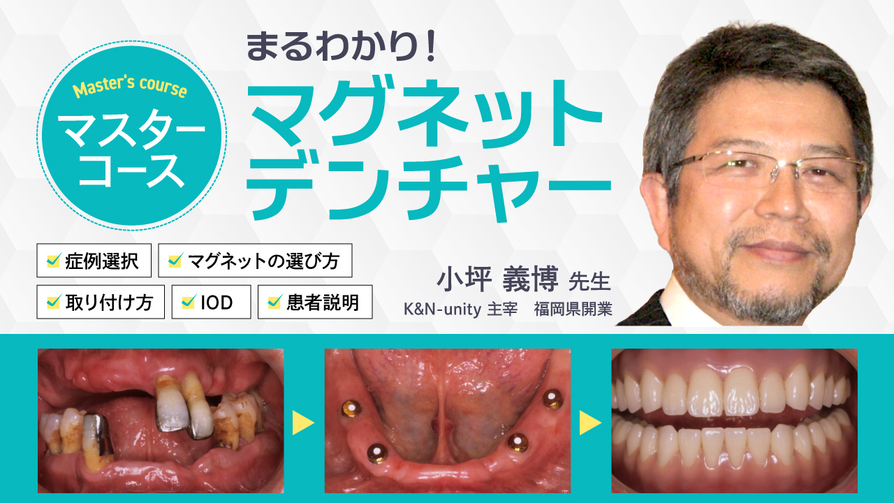 【マスターコース】まるわかりマグネットデンチャーの画像です。