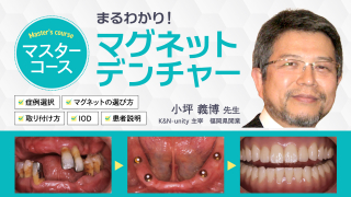 【マスターコース】まるわかりマグネットデンチャーの画像です。