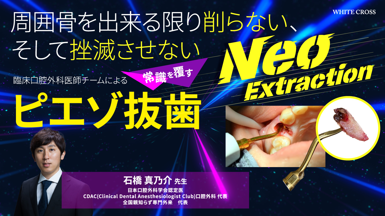 Neo Extraction 臨床口腔外科医師チームによる常識を覆すピエゾ抜歯の画像です。