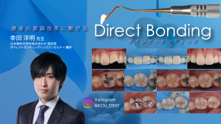 患者の意識改革に繋がるダイレクトボンディングの画像です。