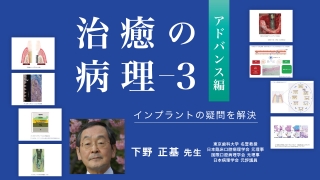 サイナスフロアエレベーション アルティメットガイド 全てを満たす究極
