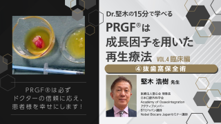 Dr.堅木の15分で学べる〜PRGF®は成長因子を用いた再生療法【Vol.4 ④抜歯窩保全術】〜の画像です。