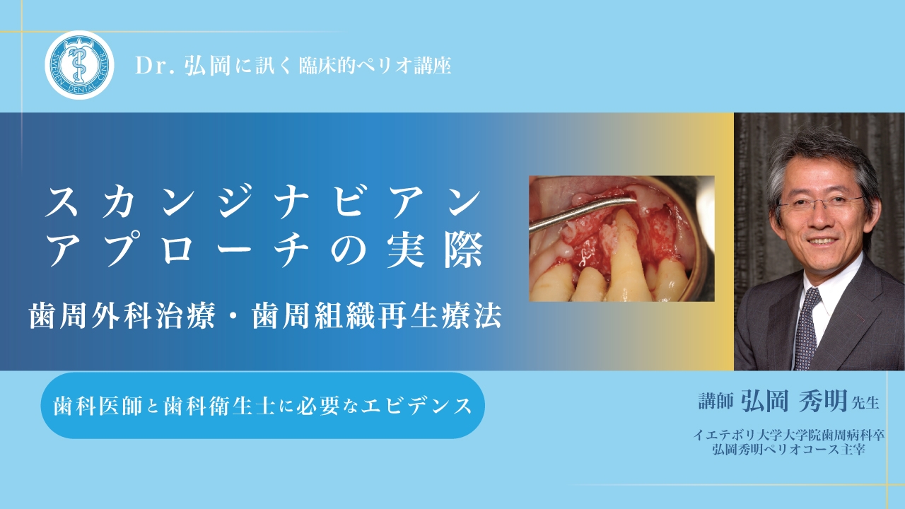 Dr.弘岡に訊く臨床的ペリオ講座 スカンジナビアンアプローチの実際〜歯