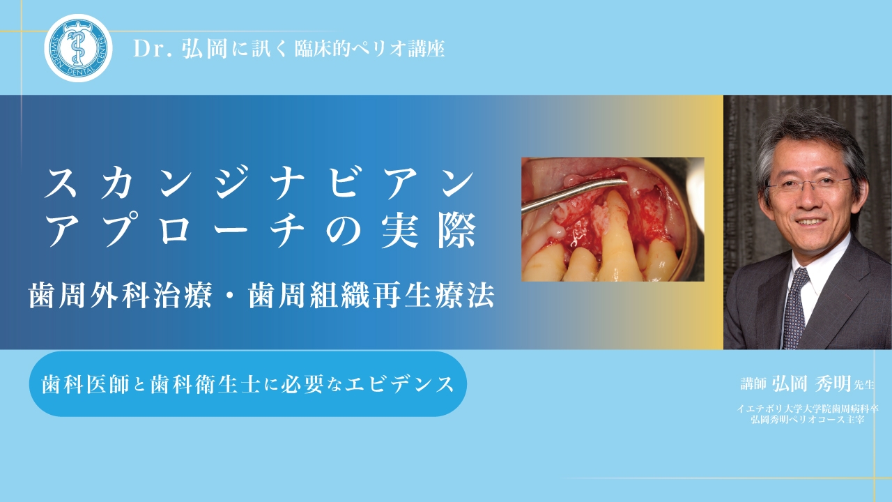 Dr.弘岡に訊く臨床的ペリオ講座 スカンジナビアンアプローチの実際〜歯