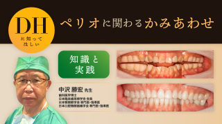 DHに知ってほしい「ペリオに関わるかみあわせ」〜知識と実践〜の画像です。