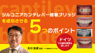 デジタルを用いた補綴臨床の可視化に挑む | WHITE CROSS