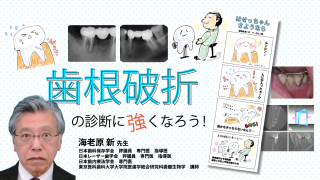 歯根破折の診断に強くなろう！の画像です。