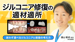 ジルコニア修復の適材適所の画像です。