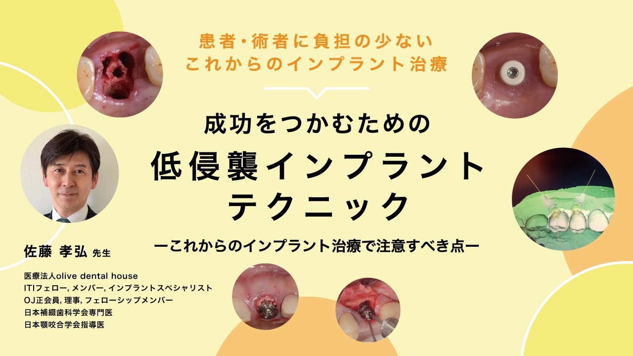 患者・術者に負担の少ないこれからのインプラント治療 成功をつかむ