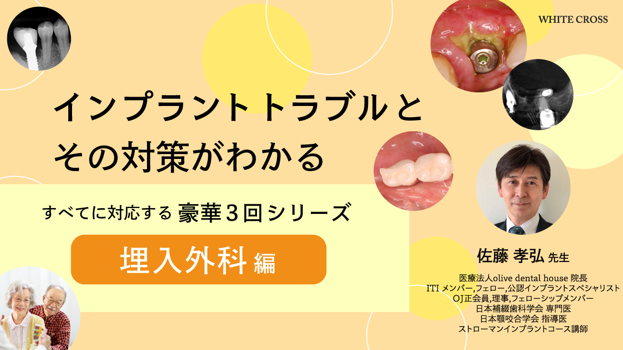 インプラントトラブルへの対処方法 そして起こさないために すべてに対応する3回シリーズ 〜埋入外科編〜の画像です。