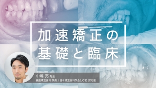 加速矯正の基礎と臨床の画像です。