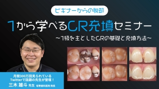 ビギナーからの脱却 1から学べるCR充填セミナー～1級を主としたCRの基礎と充填方法～の画像です。