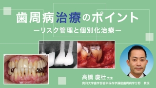 歯周病治療のポイント　-リスク管理と個別化治療–の画像です。