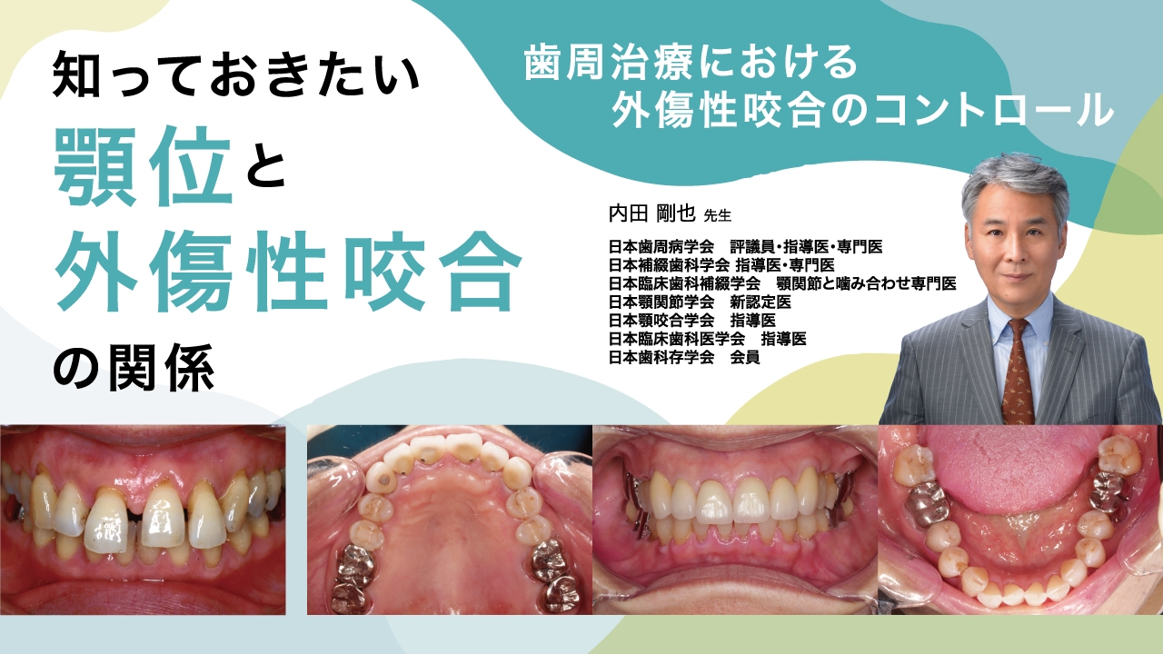 知っておきたい顎位と外傷性咬合の関係の画像です。