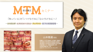 MTM（部分矯正）セミナー「知っている」を「いつでもできる」「なんでもできる」へ！～レベリング・エクストルージョン・アップライト・圧下の有効活用～の画像です。