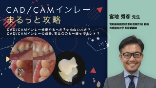 CAD/CAMインレーまるっと攻略の画像です。