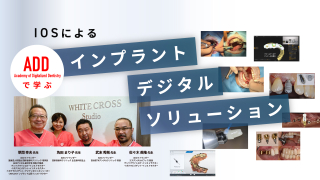 新スタンダード歯科小手術 新 スタンダード歯科小手術| 歯科総合出版社 デンタルダイヤモンド社
