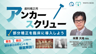 歯科矯正用アンカースクリュー〜部分矯正を臨床に導入しよう〜の画像です。