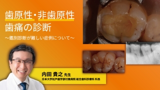 歯原性・非歯原性歯痛の診断～鑑別診断が難しい症例について～の画像です。