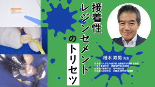 接着性レジンセメントのトリセツの画像です。