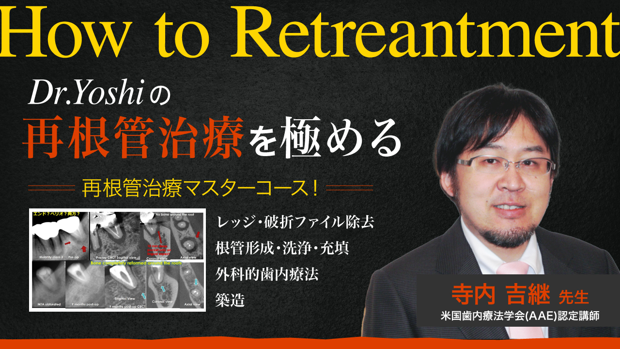 How to Retreatment ～Dr.Yoshiの 再根管治療を極める～ | WHITE