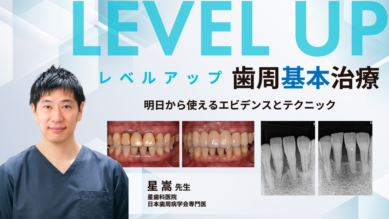 レベルアップ歯周基本治療〜明日から使えるエビデンスとテクニック〜の画像です。