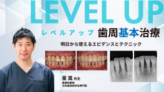 レベルアップ歯周基本治療〜明日から使えるエビデンスとテクニック〜の画像です。