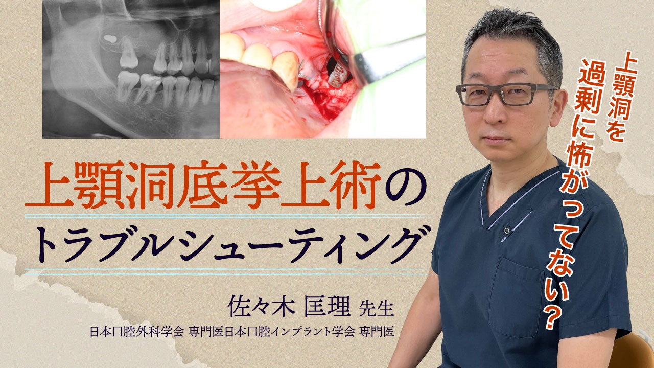 上顎洞底挙上術のトラブルシューティング〜上顎洞を過剰に怖がってない