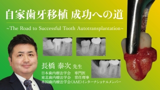 自家歯牙移植 成功への道の画像です。