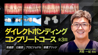 ダイレクトボンディング完全網羅 全3回コース～前歯部・臼歯部・接着ブリッジ～の画像です。