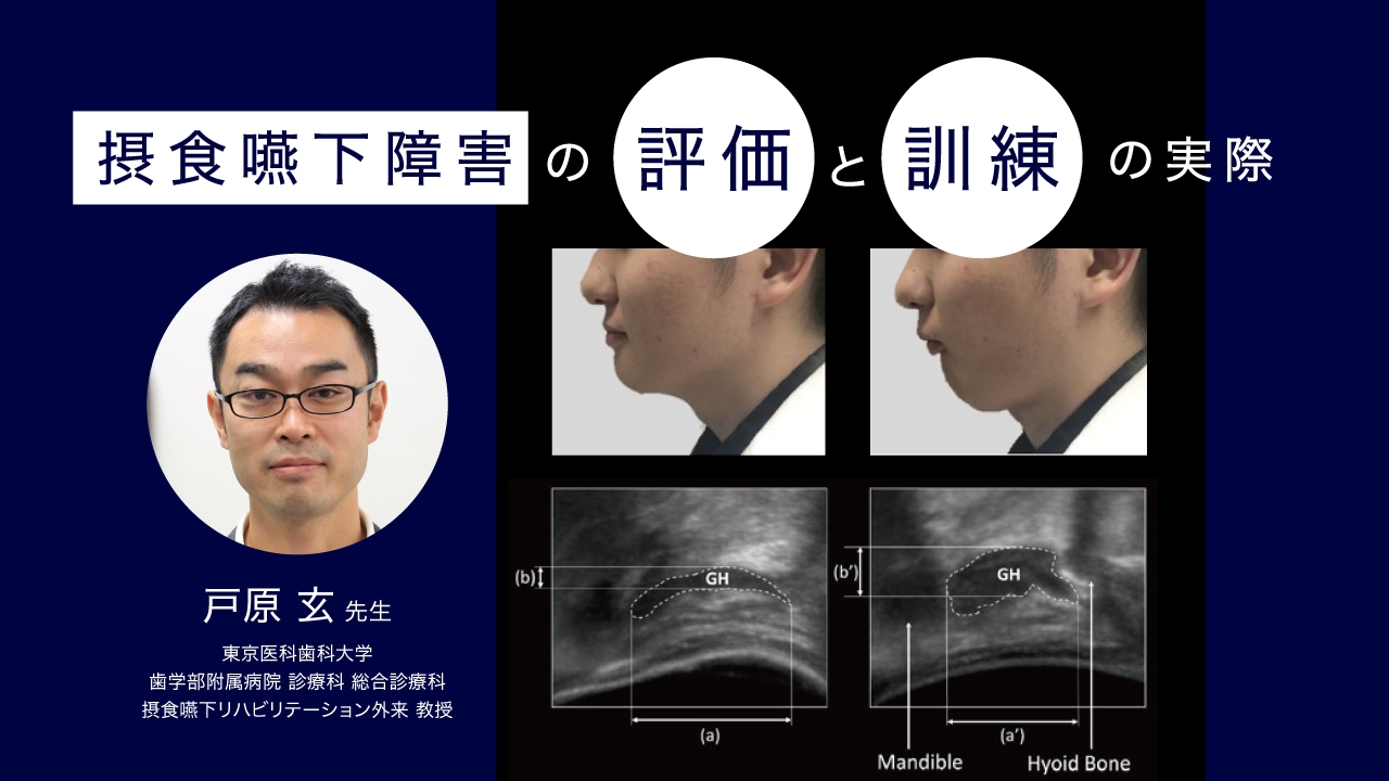 摂食嚥下障害の評価と訓練の実際の画像です。