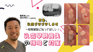 先生、乳歯グラグラします 一般開業医に知って欲しい！乳歯早期喪失の傾向と対策の画像です。