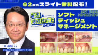 審美と清掃性向上のためのソフトティッシュマネージメントの画像です。