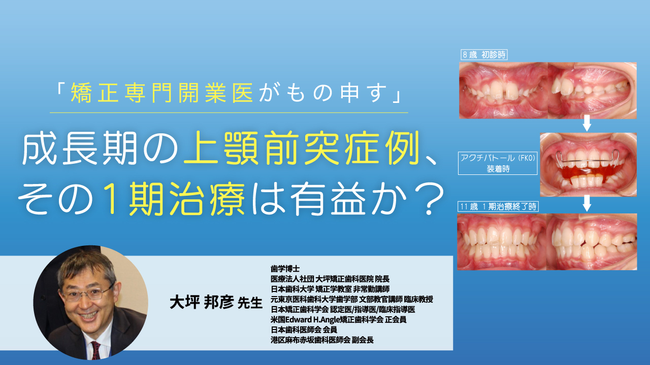 「矯正専門開業医がもの申す」 成長期の上顎前突症例、その1期治療は有益か?の画像です。
