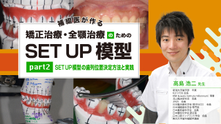 補綴医が作る 矯正治療・全顎治療のための「SET UP 模型」part2〜SET UP模型の配列位置決定方法と配列実践〜の画像です。