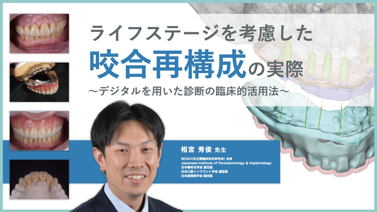 ライフステージを考慮した咬合再構成の実際の画像です。
