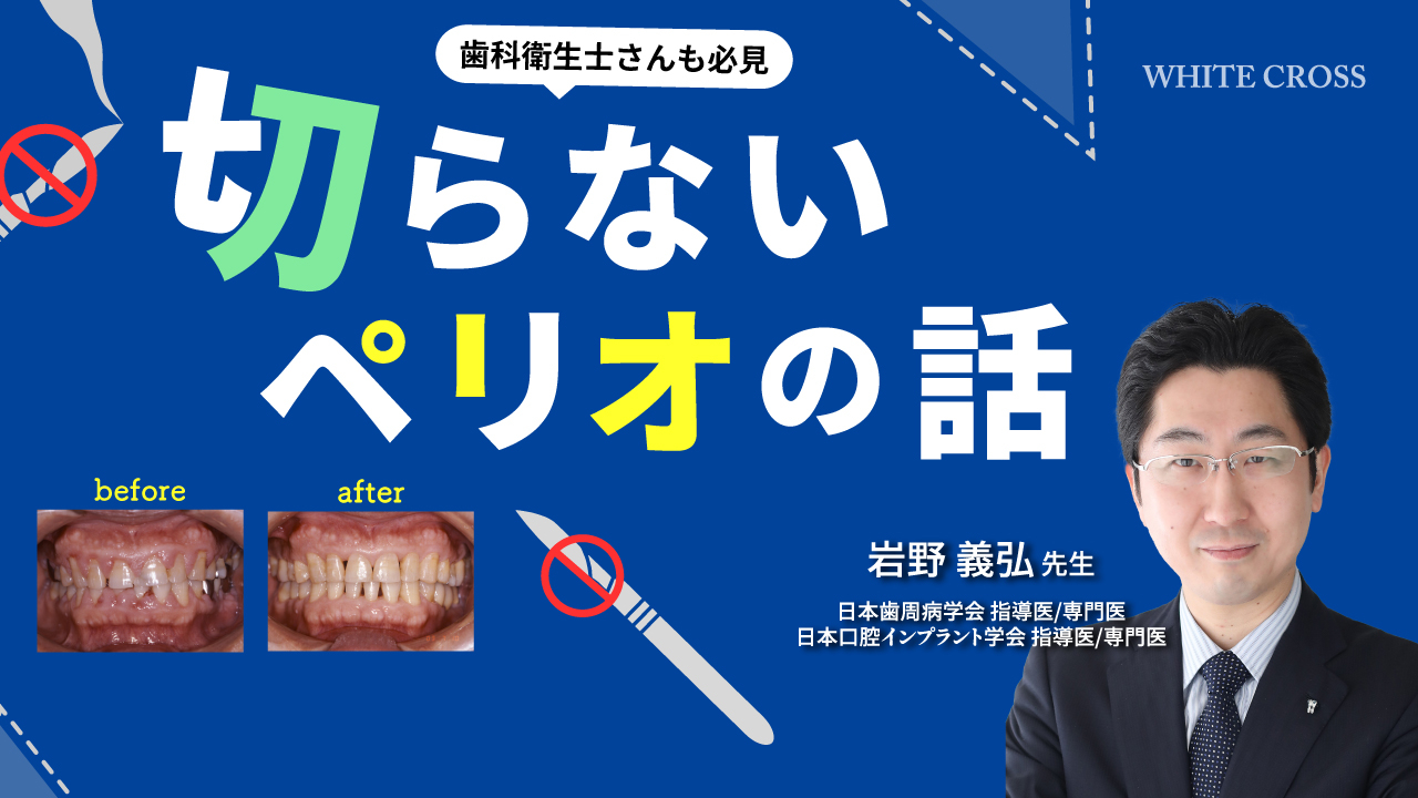 切らないペリオの話の画像です。