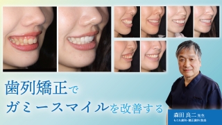 外れることなく超精密かつ最速のアタッチメント設置が実現！年間600