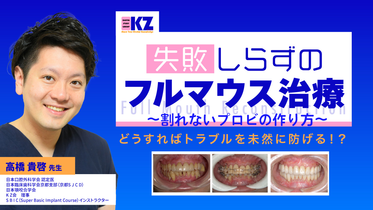 失敗しらずのフルマウス治療〜割れないプロビの作り方〜の画像です。