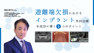 遊離端欠損におけるインプラント外科治療を成功に導く4つのポイントの画像です。