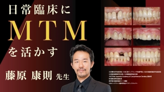 MIDの理念に沿った根面う蝕のマネジメント戦略 | WHITE CROSS