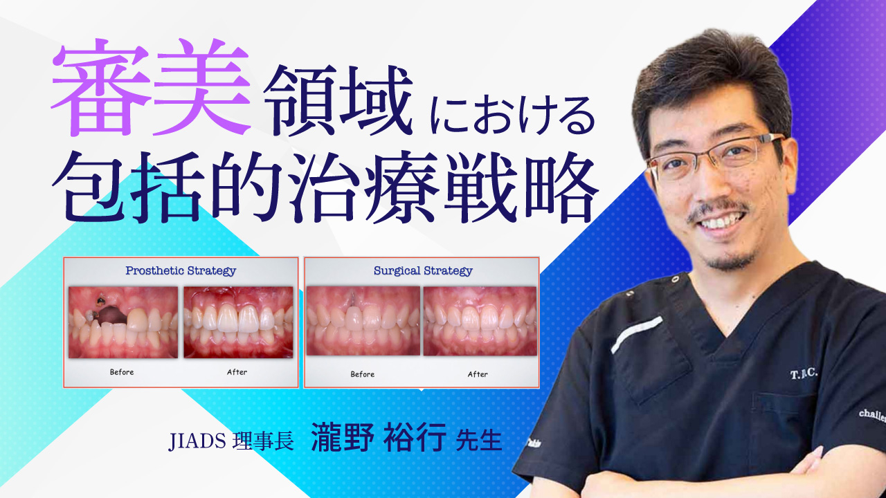 審美領域における包括的治療戦略の画像です。