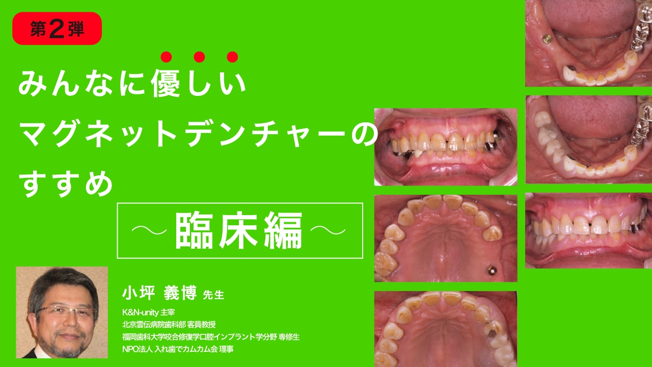 臨床に即応できる! 総義歯吸着への7つのステップ+Q&amp;A: コピーデンチャーテクニックと総義歯臨床Q&amp;A 51Sg7qH2t9L._AC_SY200_QL15_.jpg