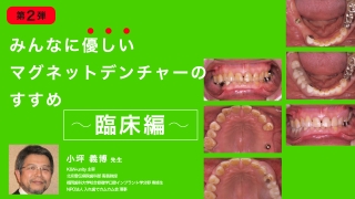 第2弾！みんなに優しいマグネットデンチャーのすすめ〜臨床編〜の画像です。