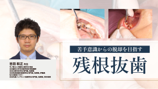 苦手意識からの脱却を目指す残根抜歯の画像です。