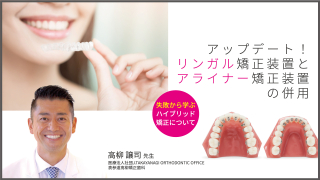 アップデート！リンガル矯正装置とアライナー矯正装置の併用〜失敗から学ぶハイブリッド矯正について〜の画像です。