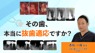 その歯、本当に抜歯適応ですか？の画像です。