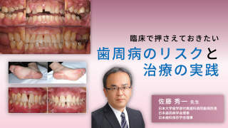 臨床で押さえておきたい歯周病のリスクと治療の実践の画像です。